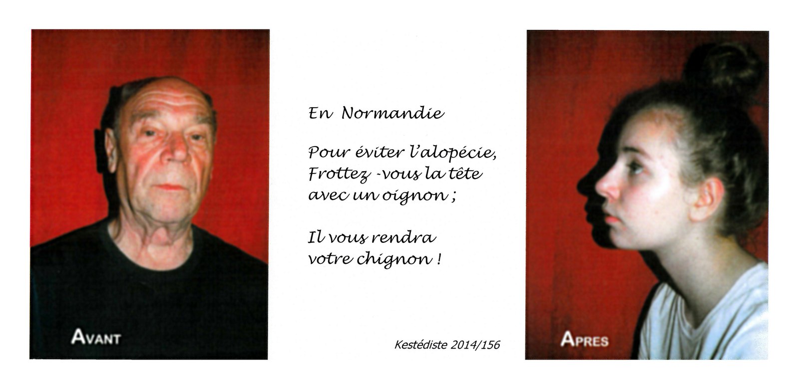 Kestédite 2014/156